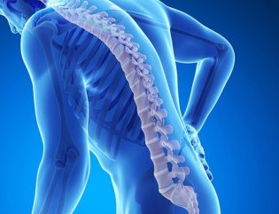 Osteoporosis