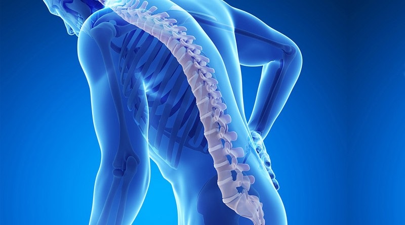 Osteoporosis