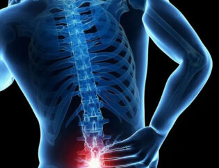 osfyalgia1