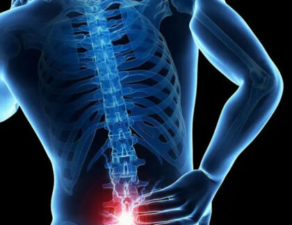 osfyalgia1