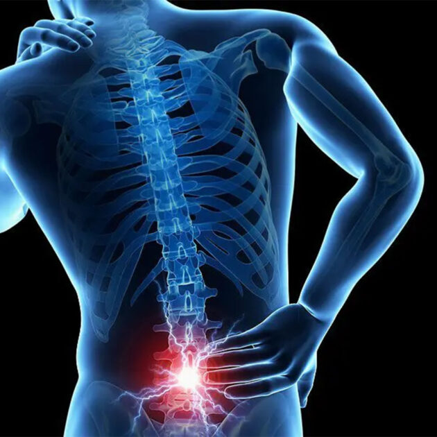 osfyalgia1