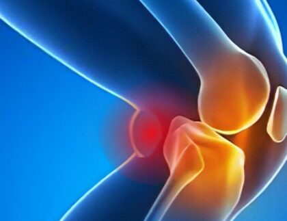 bakers cyst treatment osmo patch 1170x650 1