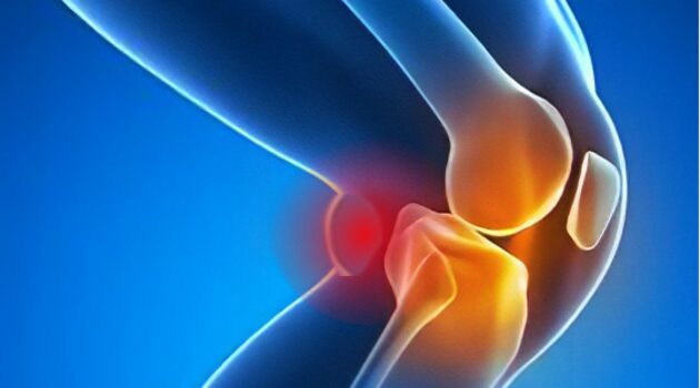 bakers cyst treatment osmo patch 1170x650 1