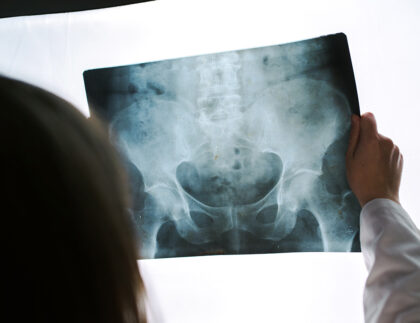 female doctor examining pelvis x ray in hospital o 2021 08 26 23 02 53 utc