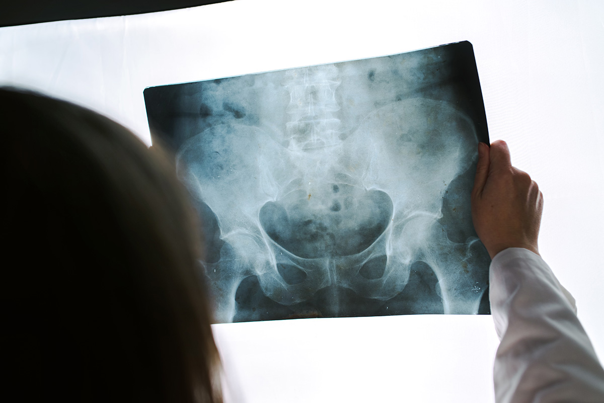 female doctor examining pelvis x ray in hospital o 2021 08 26 23 02 53 utc