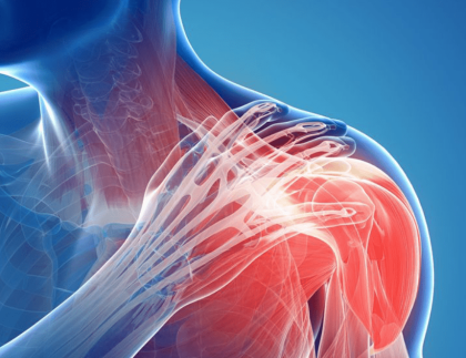2314182