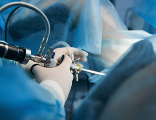 unrecognizable woman undergoing hysteroscopy in th 2023 02 02 01 16 21 utc