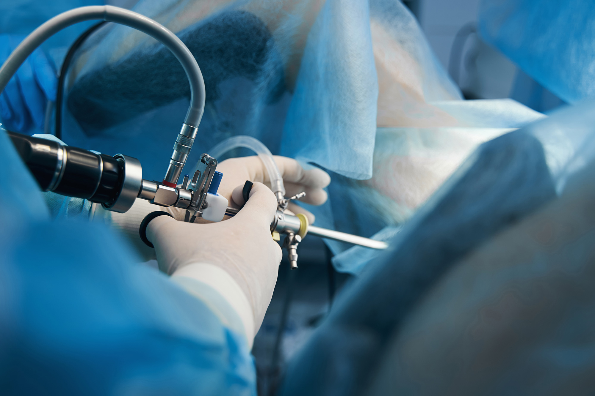 unrecognizable woman undergoing hysteroscopy in th 2023 02 02 01 16 21 utc